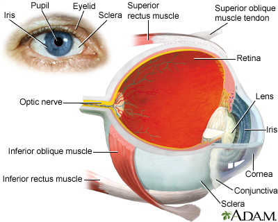 eye detachment