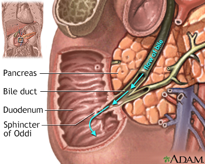 common bile duct and pancreatic duct. Bile duct obstruction