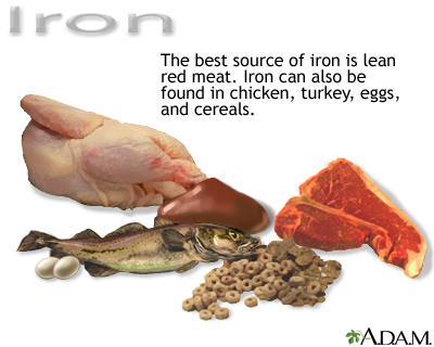 Iron Supplements on You May Also Be Given Iron Supplements Such As Ferrous
